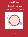 Choroby oczu