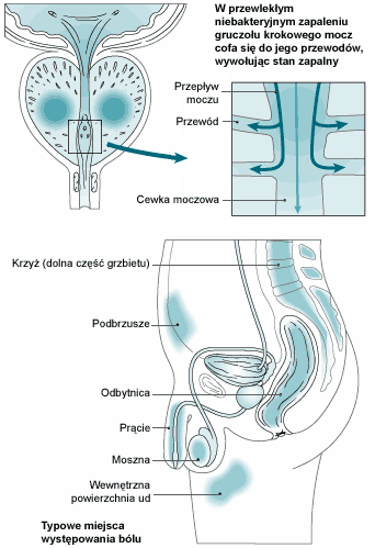 Choroby prostaty: leczenie i objawy